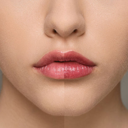 Supreme Lip Treatment - Strawberry
